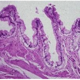 تصویر لام میکروسکوپی بافت پوششی کیسه صفرا (آموزشی) Microscopic slide of the epithelial tissue of the gallbladder (educational)