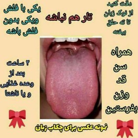 تصویر مشاوره و اموزش رایگان مزاج شناسی و زبان شناسی در طب سنتی 