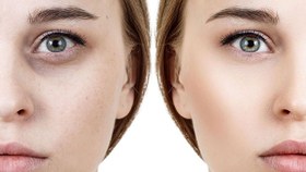 تصویر کرم چشم روشن کننده انرژی بایوون اورجینال Retinol Glow Eyes Uplift