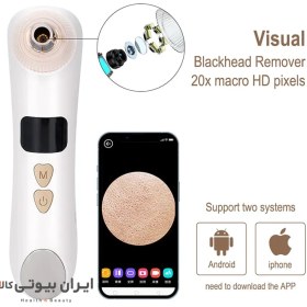 تصویر میکرودرم دوربین دار کارینا مدل E5 