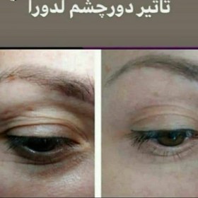 تصویر کرم دورچشم جوان کننده و‌ رفع کننده تیرگی و کاهنده چروک REJUVENATING, ANTI-DARK CIRCLE, AND REDUCING WRINKLES EYE CREAM