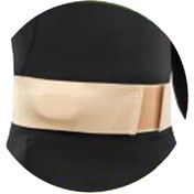 تصویر فتق بند شکمی طب و صنعت 