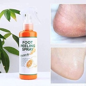 تصویر اسپری ترک و خشکی پا foot peeling spray 
