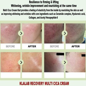 تصویر کرم مرطوب‌ کننده و ترمیم‌ کننده سد دفاعی پوست سوپر سیکا برند کلالب KLALAB Recovery Multi CICA Cream 80ml 