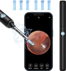 تصویر گوش پاک کن هوشمند دوربین دار VITCOCO 5MP با ۶ LED و اتصال وای‌فای | آمازونیکس 