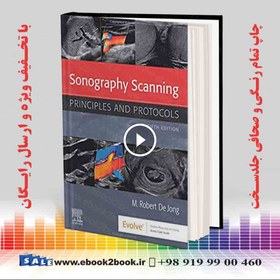 Lev Protocol Songraph خرید و قیمت کتاب سونوگرافی اسکننینگ Sonography Scanning : Principles ...