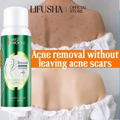 تصویر اسپری درمان جوش بدن 