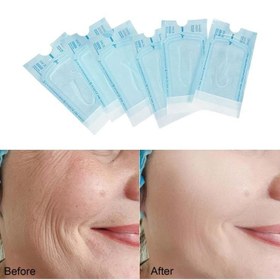 تصویر نخ کلاژن لیفتینگ و ضدچروک ۱۲ عددی | برند لوکس و باکیفیت نخ کلاژن لیفتینگ و ضدچروک ۱۲ عددی | برند لوکس و باکیفیت