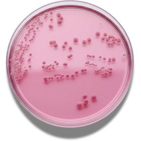 تصویر محیط کشت اماده VRBD agar | Violet Red Bile Dextrose agar YGC Agar culture medium for Gluconobacter xylinus bacteria