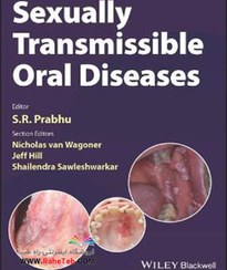 تصویر Sexually Transmissible Oral Diseases 1st Edition, Kindle Editionبیماری های دهان و دندان قابل انتقال از طریق جنسی 