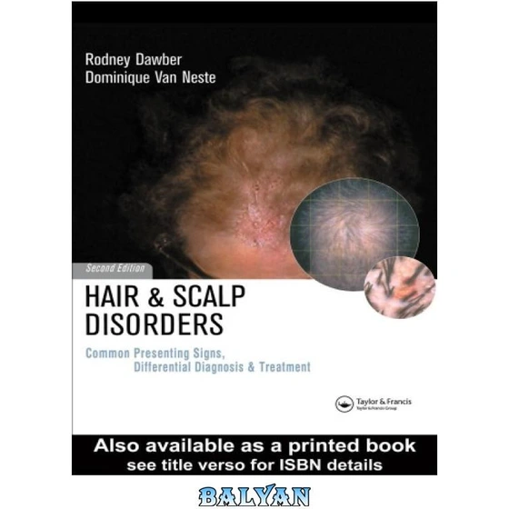 خرید و قیمت دانلود کتاب Hair and scalp disorders common presenting