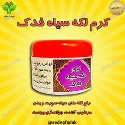 تصویر کرم لکه سیاه فدک 