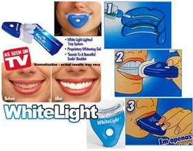 تصویر سفید کننده دندان خانگی 