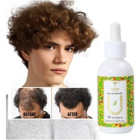 تصویر روغن رشد مجدد مو اتوکئونز مدل Yellow Fifteen Otto Kaunis Yellow Fifteen Hair Growth Oil