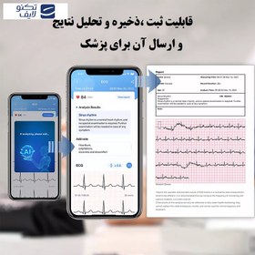 تصویر فشارسنج و نوار قلب دیجیتالی هوشمند Wellue Armfit PLUS برند :