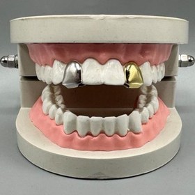 تصویر گریلز دندان 