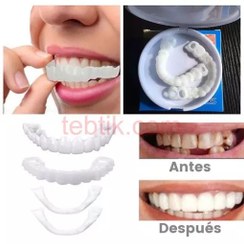 تصویر لمینت متحرک دندان اسنپ ان اسمایل Snap On Smile 