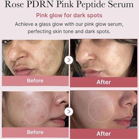 تصویر سرم صورتی روشن کننده و پپتاید مدی کیوب MEDICUBE PDRN PINK PEPTIDE SERUM 