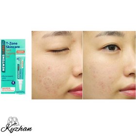 تصویر ژل ضد جوش تی‌زون 