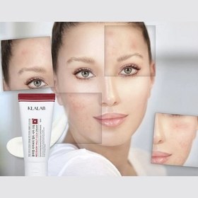 تصویر کرم ریکاوری و ترمیم کننده مولتی سیکا کلالب Klalab Recovery Multi CICA Cream