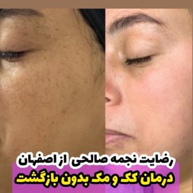 تصویر ضد لک دائمی 