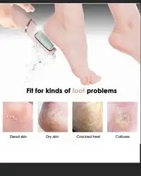 تصویر سنگ پا شارژی 