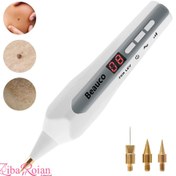 تصویر دستگاه پلاسما زیکن کندلا مدل شارژی و برقی 