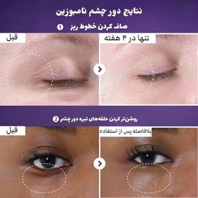 تصویر کرم دور چشم نامبوزین - ضد تیرگی، ضد چروک و آبرسان Numbuzin Eye Cream - Dark Circle Care, Anti-Wrinkle & Hydrating
