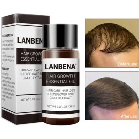 تصویر روغن تقویت کننده مو Lanbena مدل ESSENCE GROWTH 