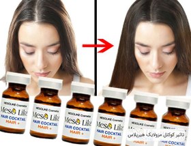 تصویر کوکتل ضد ریزش مو مزولایک حجم ۱۰ میلی لیتر 