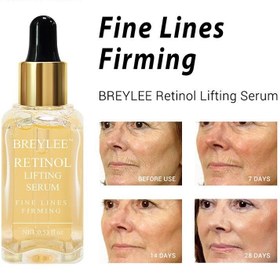 تصویر سرم لیفتینگ رتینول بریلی 17 میل BREYLEE RETINOL LIFTING SERUM