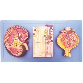 تصویر مولاژ کلیه 3 قسمتی 