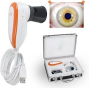 تصویر دستگاه تشخیص سلامت از طریق عنبیه‌سنجی با تکنولوژی دیجیتال - آنالایزر عنبیه پیشرفته EH-990U EH-990U Iris Analyzer Advanced