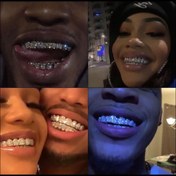 تصویر گرلیز فول نگین فک بالا 