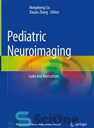 خرید و قیمت دانلود کتاب Pediatric Neuroimaging: Cases and Illustrations ...