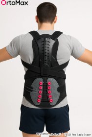 تصویر کمربند قرقره ای طبی TLSO پرو 