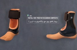 تصویر پای مصنوعی روی مچ با سوکت کامپوزیت کربن (پروتز کربنی سایم مچ پا) 