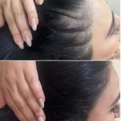 تصویر اسکالپ سر بانوان 