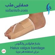 تصویر اصلاح‌کنندۀ انگشت شست پا، محافظ هالوکس والگوس(Hallux Valgus brace) 