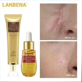 تصویر سرم ترمیم کننده و رفع جای جوش، اسکار و بخیه سرم پوست herbal skin care serum ۲۰میلی لیتر لانبنا