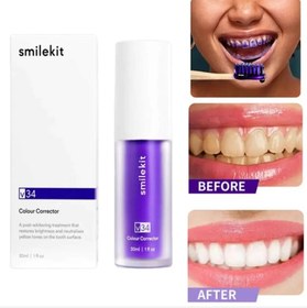 تصویر خمیر دندان سفیدکننده smilekit v34 Smilekit v34