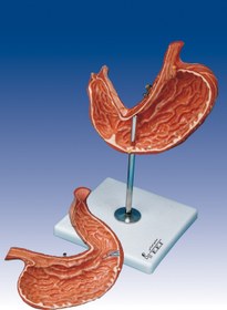 تصویر مولاژ معده 