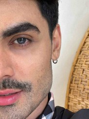 تصویر لنز طبی رنگی مارلی مدل رویال بلو 