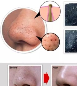 تصویر ماسک بینی ذغالی 