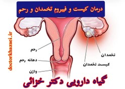 تصویر داروی گیاهی درمان رفع کیست تخمدان،تخمدان پلی کیستیک ،رفع فیبروم یا میوم ،رفع پولیپ رحم،قاعدگی های دردناک و خونریزی دهنده شدیدرفع عفونت های رحم و واژن و... 