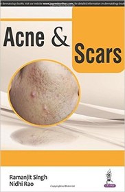 تصویر دانلود کتاب Acne & Scars 1st Edition 