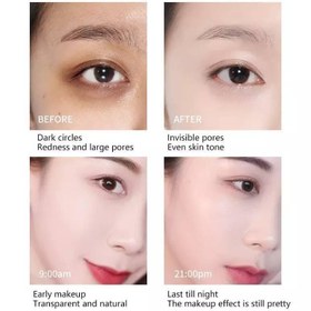 تصویر کوشن گیاهی ایکس رولند 