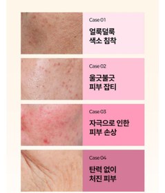 تصویر صابون سفیدکننده گلوتاتیون Gongskin 