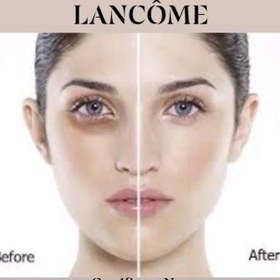 تصویر کرم دور چشم لانکوم LANCOME مدل ژنفیک Genifique حجم 5 میل 