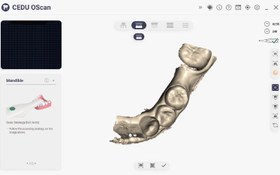 تصویر اورال اسکنر Cedu Intra Oral Scanner - Cedu